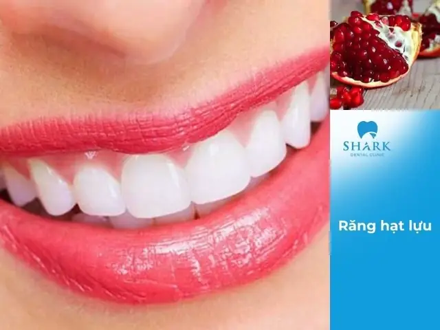Xem Tướng Răng Hạt Lựu