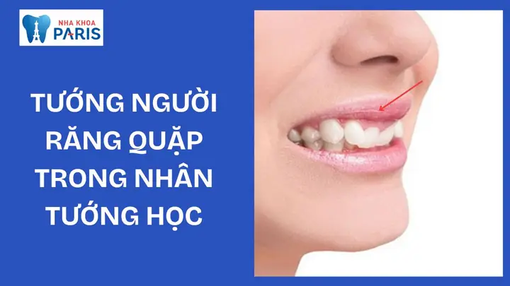 Xem Tướng Răng Quặp Xem Tướng Răng Quặp