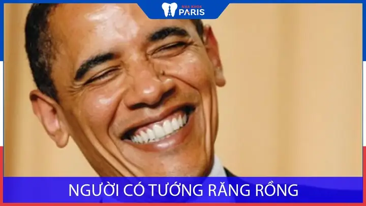 Xem Tướng Răng Rồng
