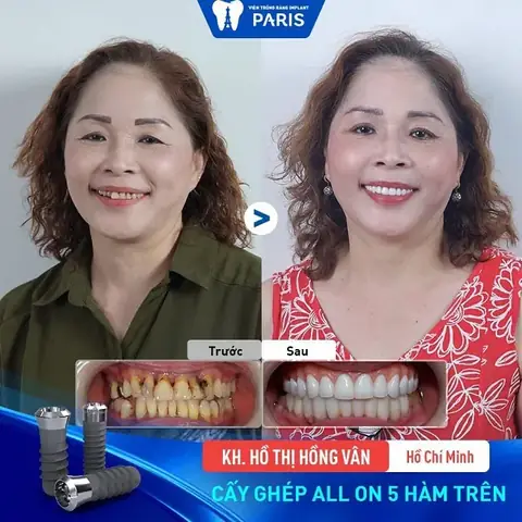 Xem Tướng Răng Rồng