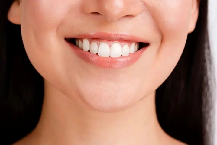 Xem Tướng Số Phụ Nữ Cười Hở Lợi