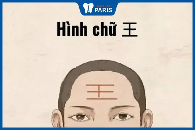 Xem Tướng Số Qua Trán Xem Tướng Số Qua Trán