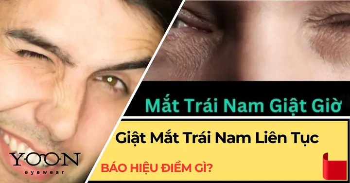Bị Giật Mắt Trái Ở Nam Là Điềm Gì