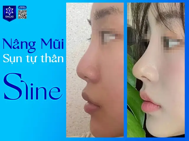 Các Tướng Mũi