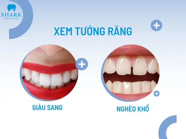 Các Tướng Răng