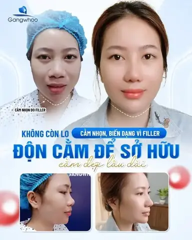 Cằm Giật La Điềm Gì