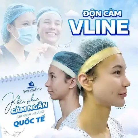 Cằm Giật La Điềm Gì
