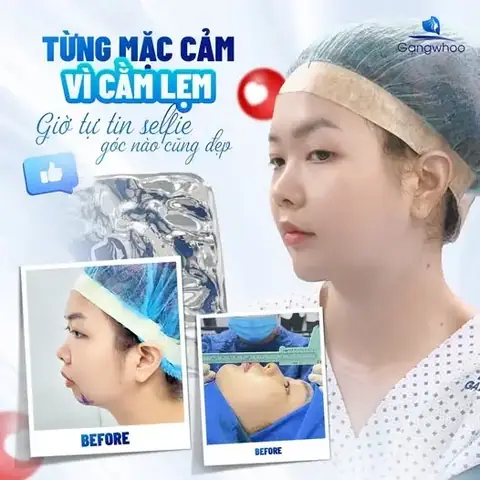 Cằm Giật La Điềm Gì