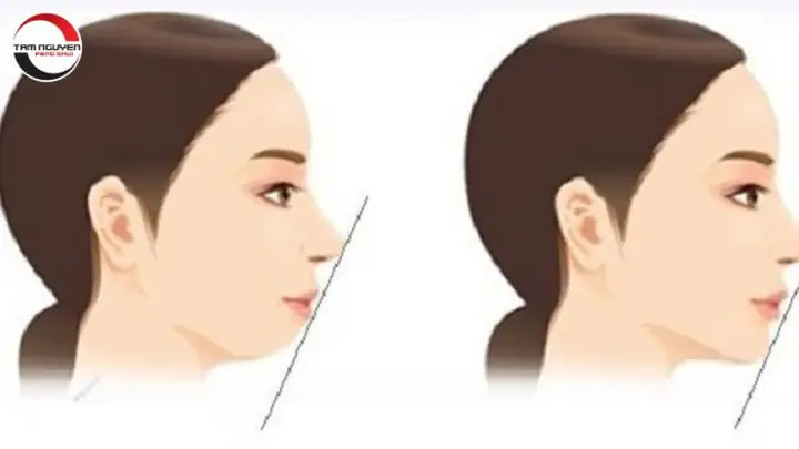 Cằm Ngắn Nhân Tướng Học Cằm Ngắn Nhân Tướng Học