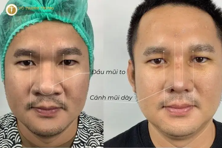 Cánh Mũi To Tướng Số