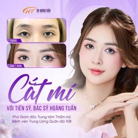 Cắt Mí Mắt Có Ảnh Hưởng Đến Tướng Số Không