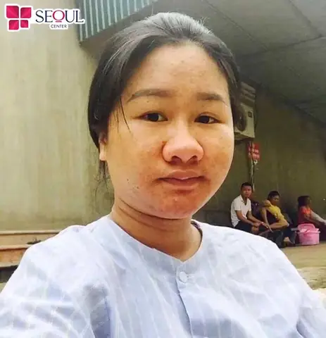 Đầu Mũi To, Cánh Mũi Dày Tướng Số