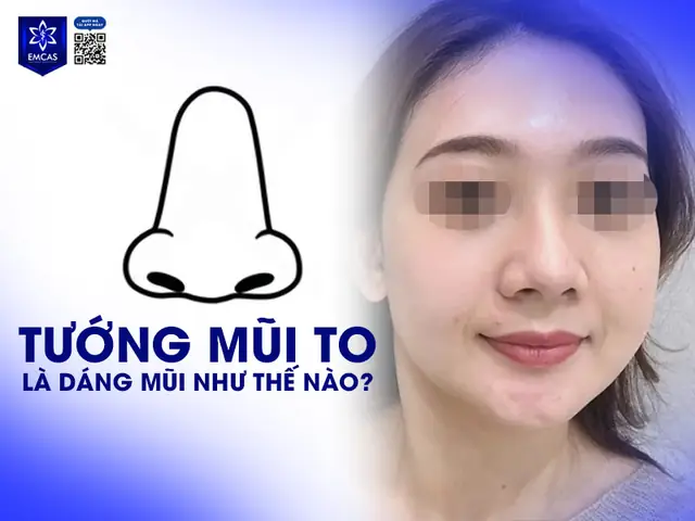 Đầu Mũi To Cánh Mũi Nhỏ Tướng Số