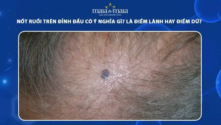 Điềm Lành Là Gì