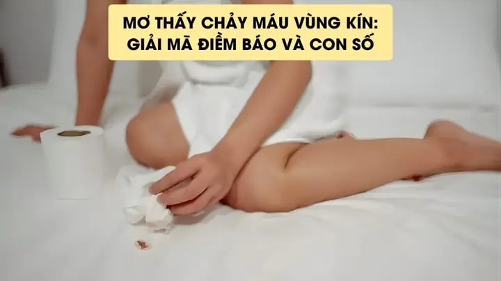 Giải Mã Giấc Mơ Bị Chảy Máu Chân Giải Mã Giấc Mơ Bị Chảy Máu Chân