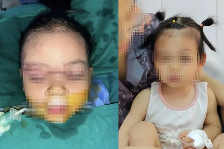Giải Mã Giấc Mơ Bị Côn Trùng Cắn Chảy Máu Giải Mã Giấc Mơ Bị Côn Trùng Cắn Chảy Máu