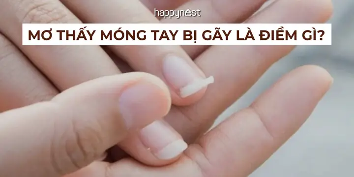 Giải Mã Giấc Mơ Bị Gãy Móng Tay Giải Mã Giấc Mơ Bị Gãy Móng Tay