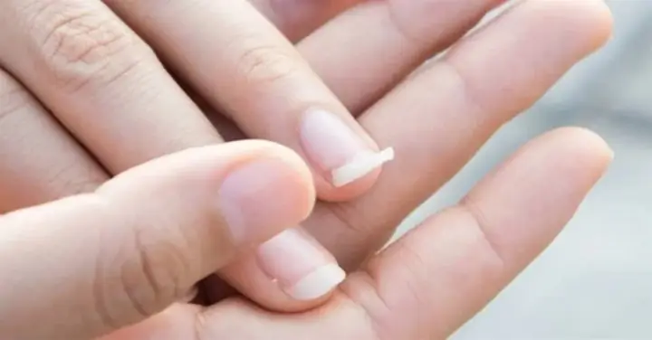 Giải Mã Giấc Mơ Bị Gãy Móng Tay Giải Mã Giấc Mơ Bị Gãy Móng Tay