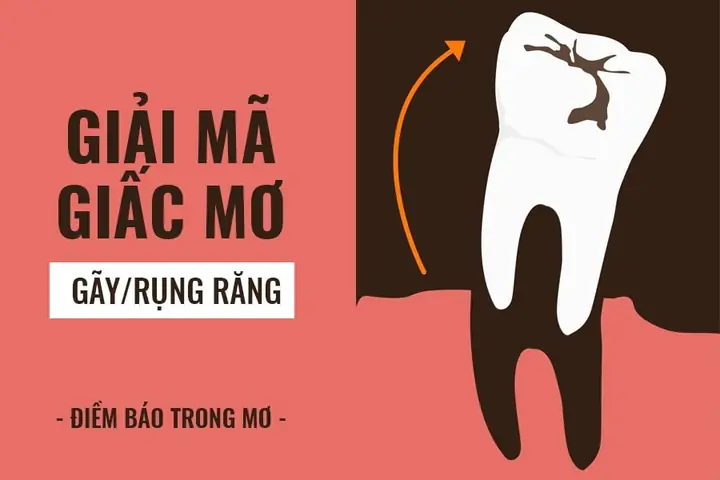 Giải Mã Giấc Mơ Bị Gãy Răng