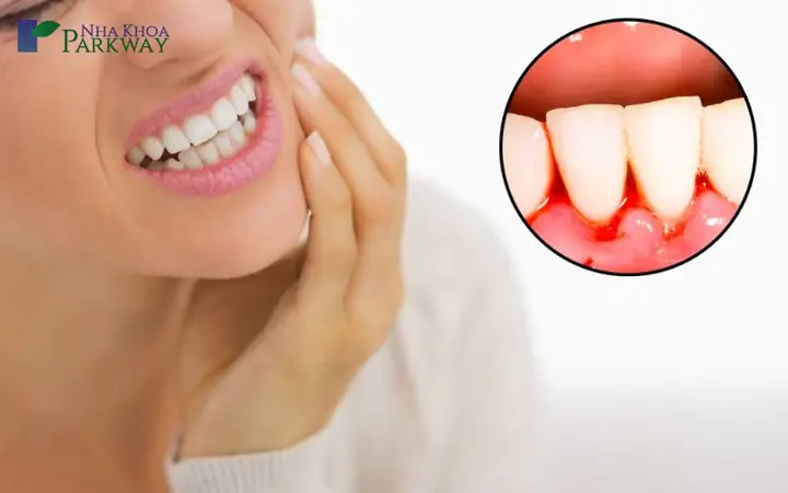Giải Mã Giấc Mơ Bị Sâu Răng