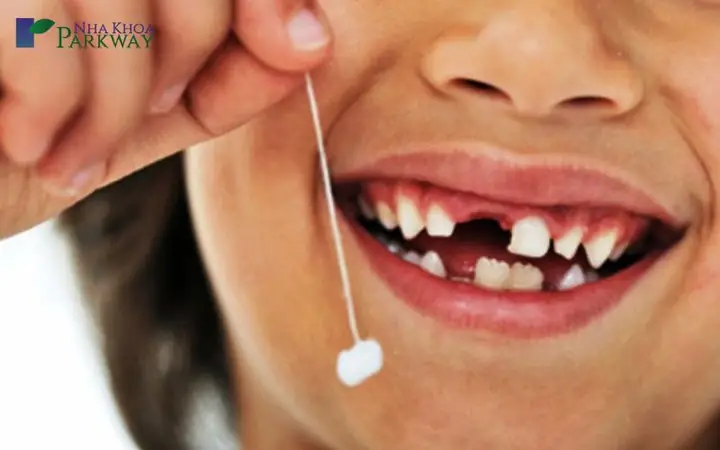 Giải Mã Giấc Mơ Bị Sâu Răng