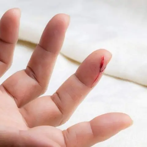 Giải Mã Giấc Mơ Đứt Tay Chảy Máu