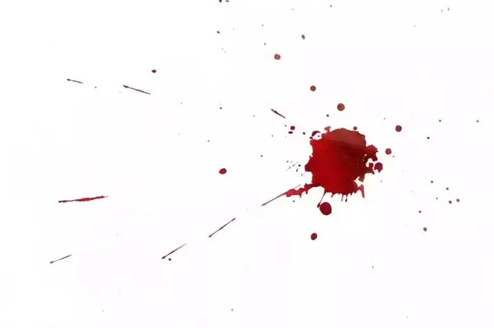 Giải Mã Giấc Mơ Đứt Tay Chảy Máu Giải Mã Giấc Mơ Đứt Tay Chảy Máu