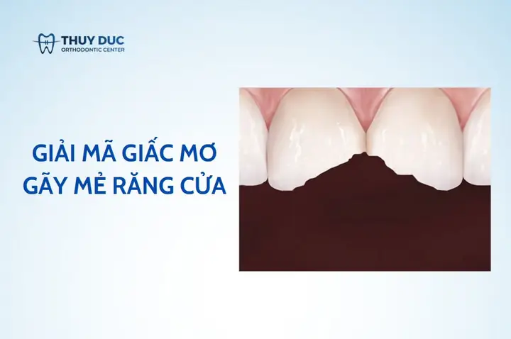 Giải Mã Giấc Mơ Lô Đề Bi Gay Rang