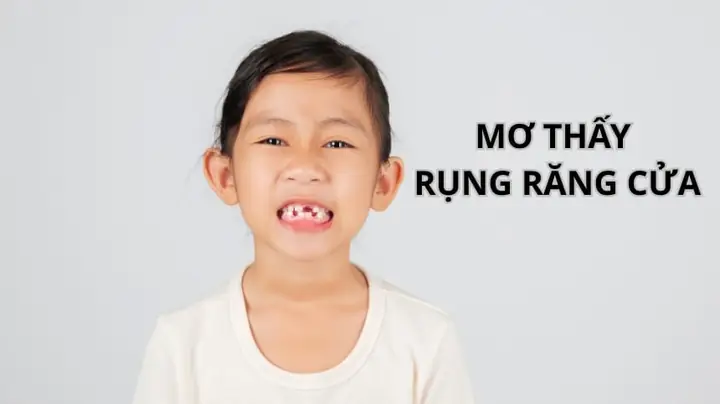 Giải Mã Giấc Mơ Rụng Răng Cửa