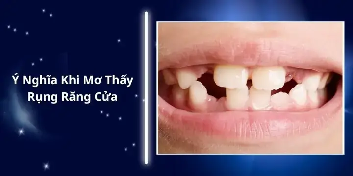 Giải Mã Giấc Mơ Rụng Răng Cửa Giải Mã Giấc Mơ Rụng Răng Cửa
