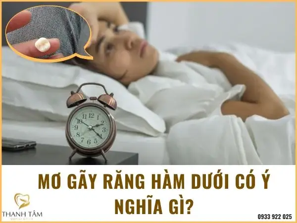 Giải Mã Giấc Mơ Rụng Răng Hàm Trên Giải Mã Giấc Mơ Rụng Răng Hàm Trên