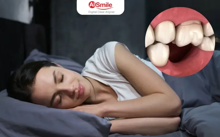 Giải Mã Giấc Mơ Rụng Răng Khểnh Giải Mã Giấc Mơ Rụng Răng Khểnh