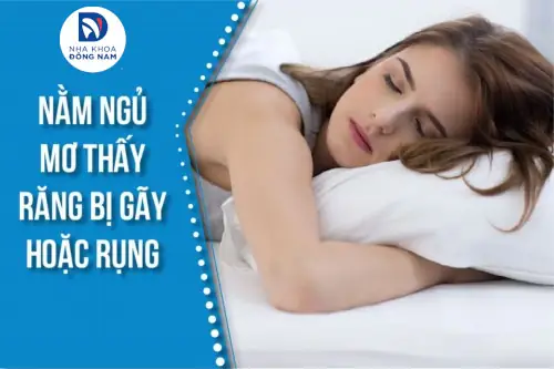 Giải Mã Giấc Mơ Thấy Bị Gãy Răng