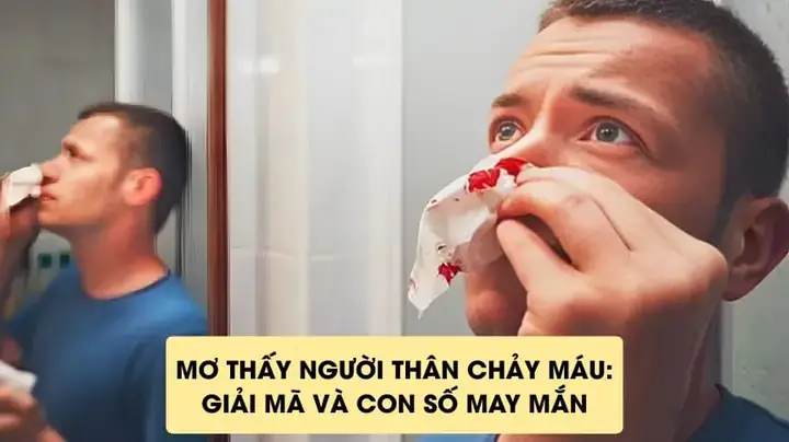 Giải Mã Giấc Mơ Thấy Người Thân Chảy Máu