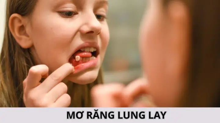 Giải Mã Giấc Mơ Thấy Ôm Sau Lưng Giải Mã Giấc Mơ Thấy Ôm Sau Lưng