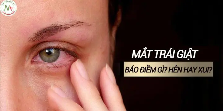 Giật Mắt Trái Nữ La Điềm Gì