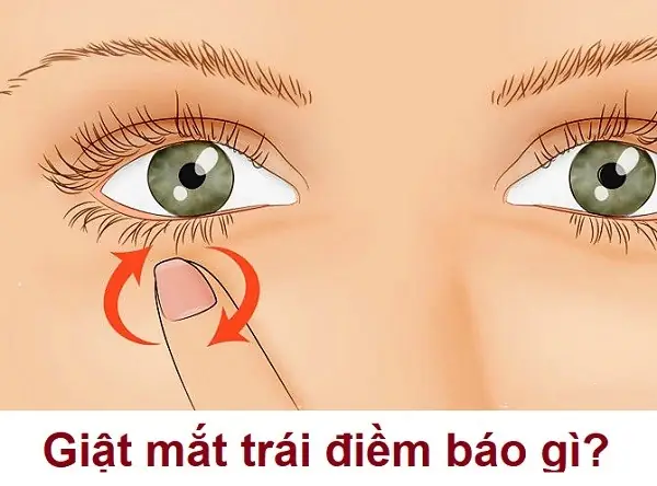 Giật Mắt Trái Nữ La Điềm Gì