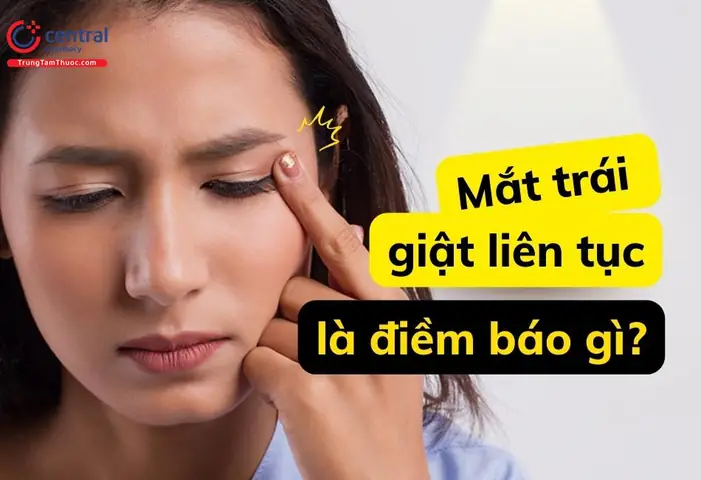 Giật Mắt Trái Nữ La Điềm Gì