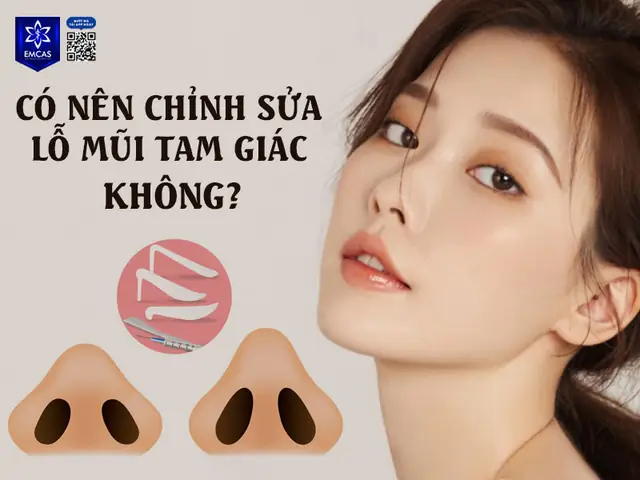 Lỗ Mũi To Trong Nhân Tướng Học