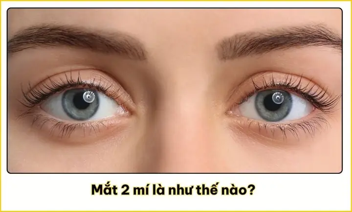 Mắt 2 Mí Nhân Tướng Học