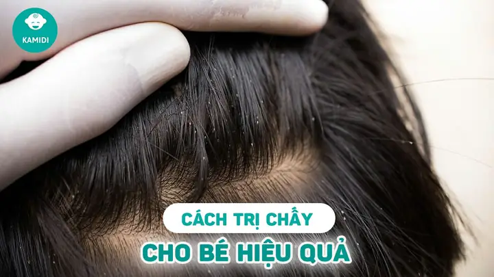 Mơ Bắt Chấy Cho Con Gái Đánh Con Gì Mơ Bắt Chấy Cho Con Gái Đánh Con Gì
