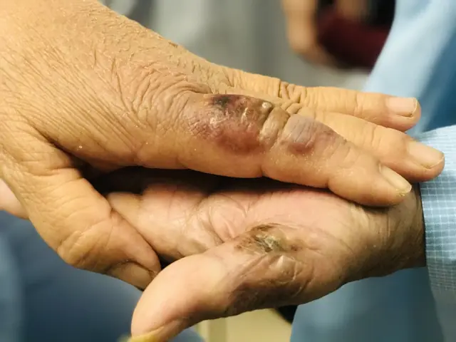 Mơ Thấy Chuột Cắn Gà Là Điềm Báo Gì