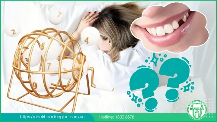 Mơ Thấy Đi Làm Răng Đánh Con Gì Mơ Thấy Đi Làm Răng Đánh Con Gì