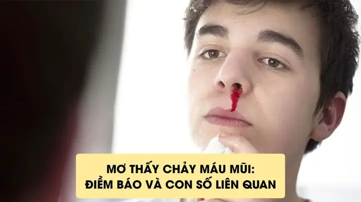 Mơ Thấy Máu Chảy Là Điềm Báo Gì