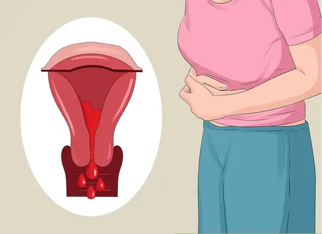 Mơ Thấy Máu Kinh Nguyệt Là Điềm Báo Gì