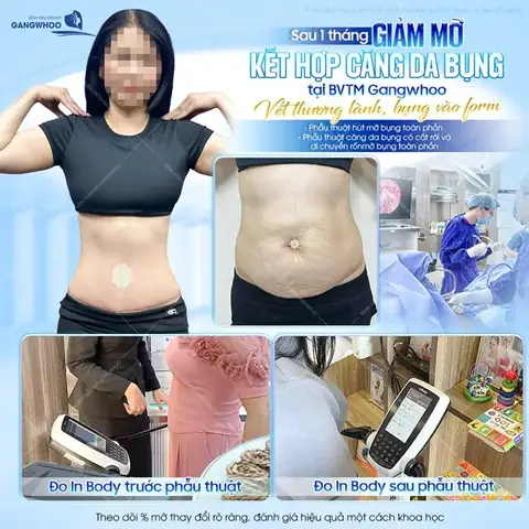 Mơ Thấy Mình Bị Phẫu Thuật Đánh Con Gì