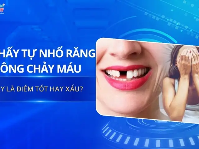 Mơ Thấy Mình Tự Nhổ Răng Lung Lay