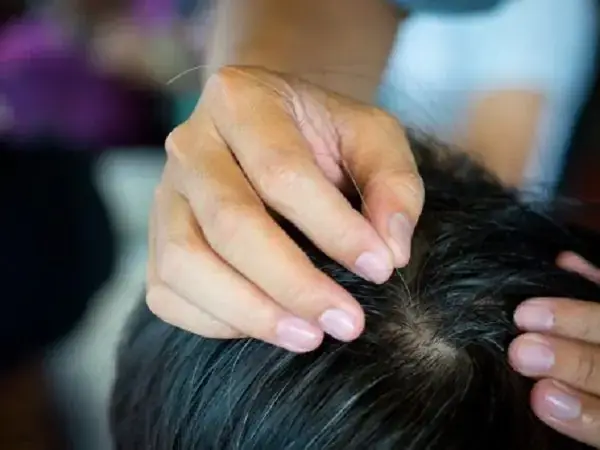 Mơ Thấy Nhổ Tóc Bạc Đánh Con Gì