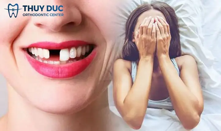 Mơ Thấy Rụng Răng Chảy Máu Là Điềm Báo Gì