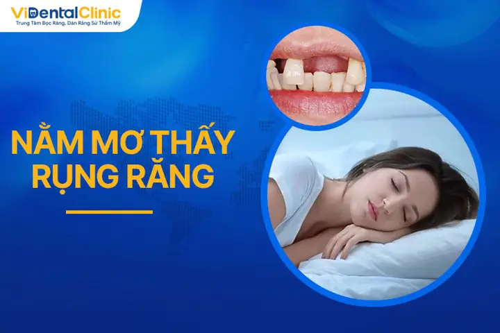 Mơ Thấy Rụng Răng Là Điềm Báo Gì